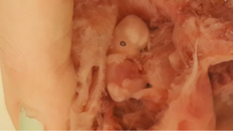 Coran et embryogenèse 2