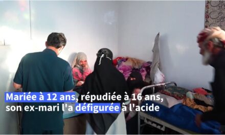 Défigurée à l’acide, Al-Anoud, 19 ans, visage des femmes brutalisées au Yémen